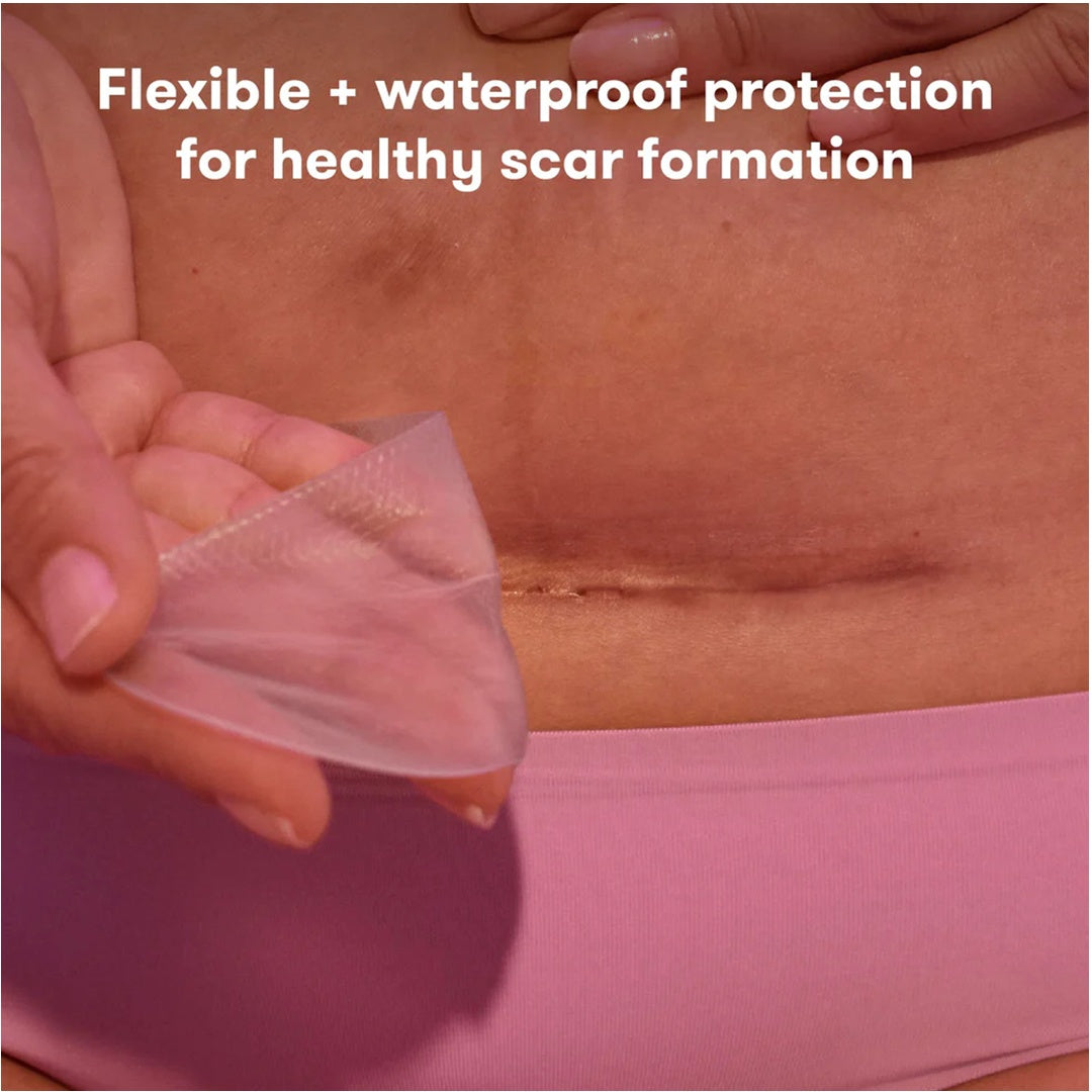 Fridababy C-Section Silicone Scar Patches