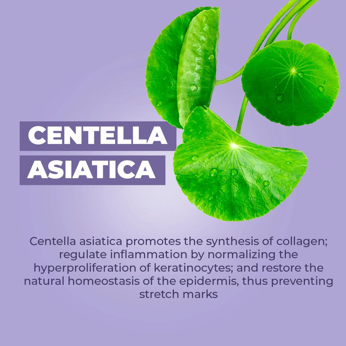 Baby Jolie Mom Care Stretch Marks Triple Action 7.5Oz