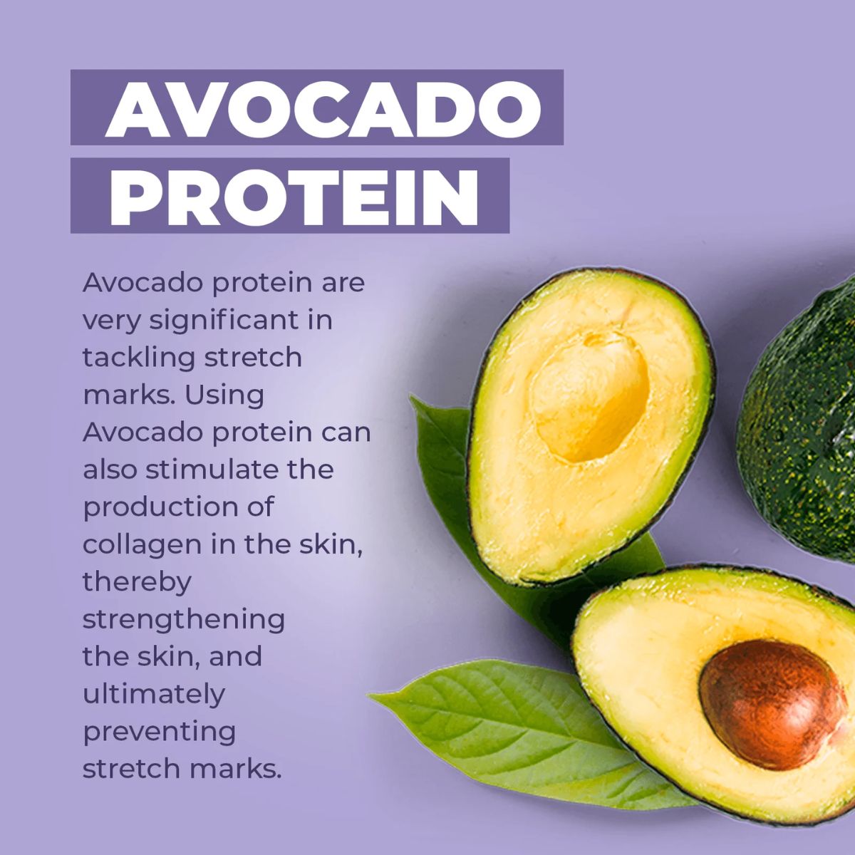 Baby Jolie Mom Care Stretch Marks Triple Action 7.5Oz