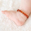 Pulseira de Âmbar Amber Crown Cor Mel - Amber Crown Babytunes